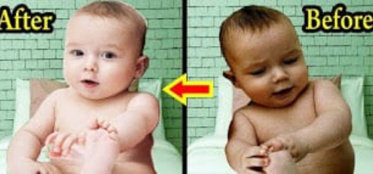 which cream is best for baby skin whitening